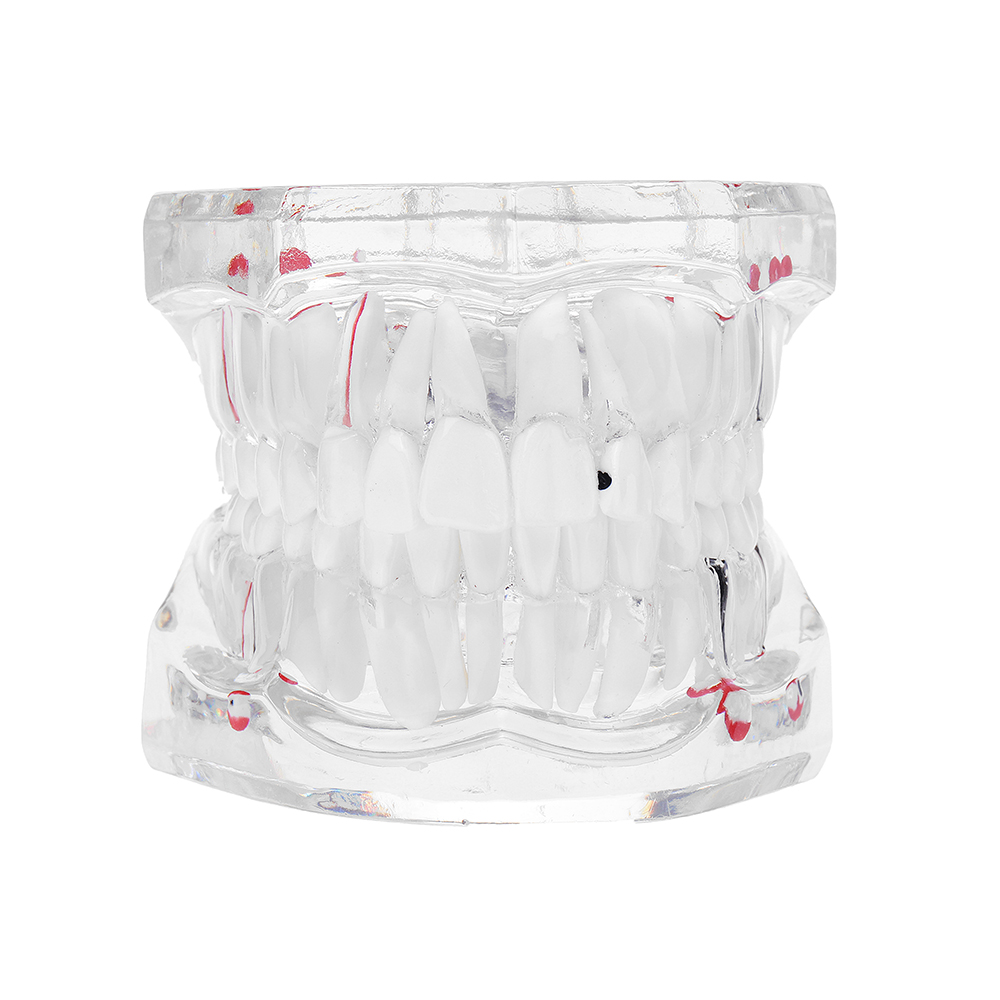 

Очистить Зубной Модель обучения зубам Кристалл Модель Typodont Съемная модель зубов Медицинская Модель