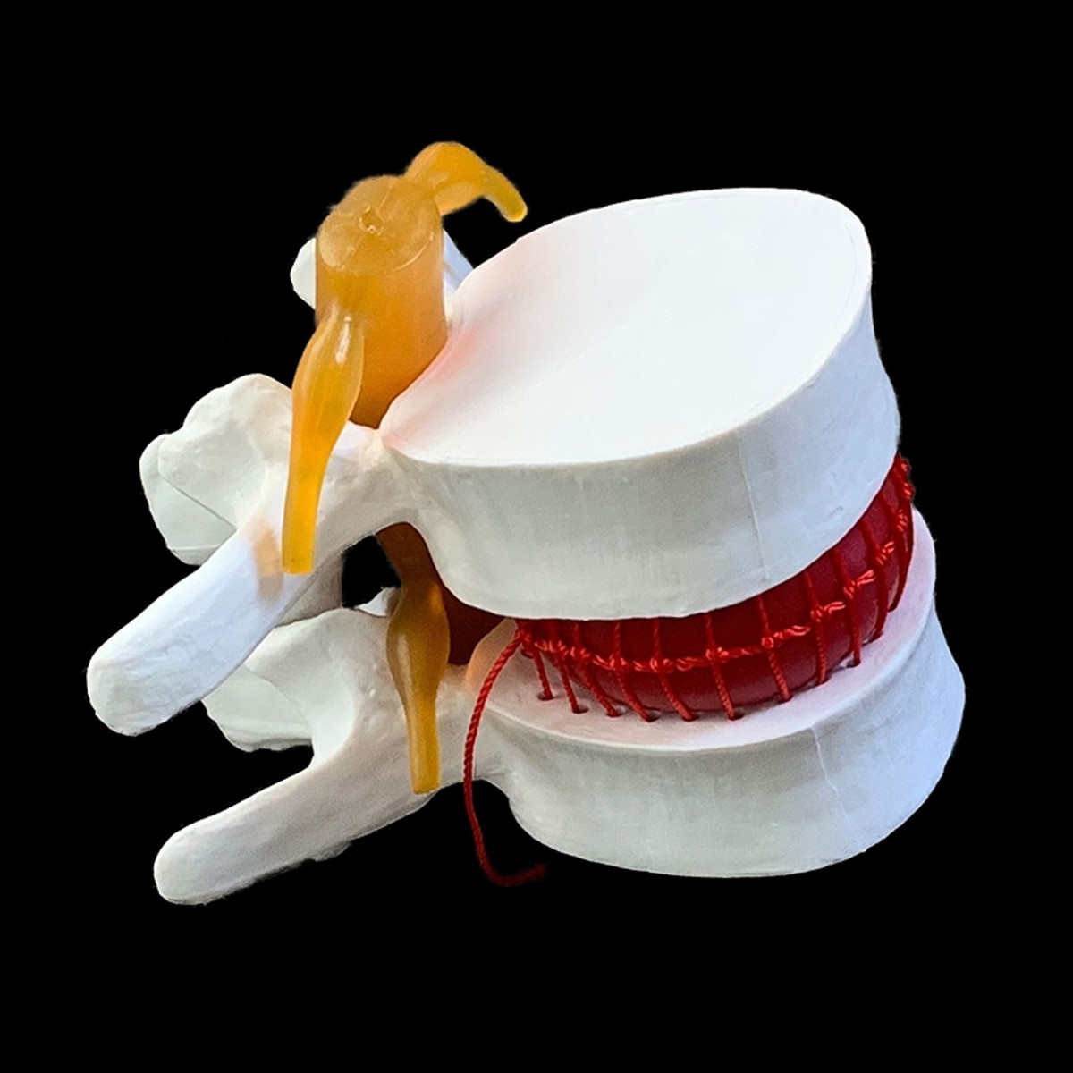 

Human Anatomy Skeleton Spine Lumbar Herniation Teaching Model Medical Science Education