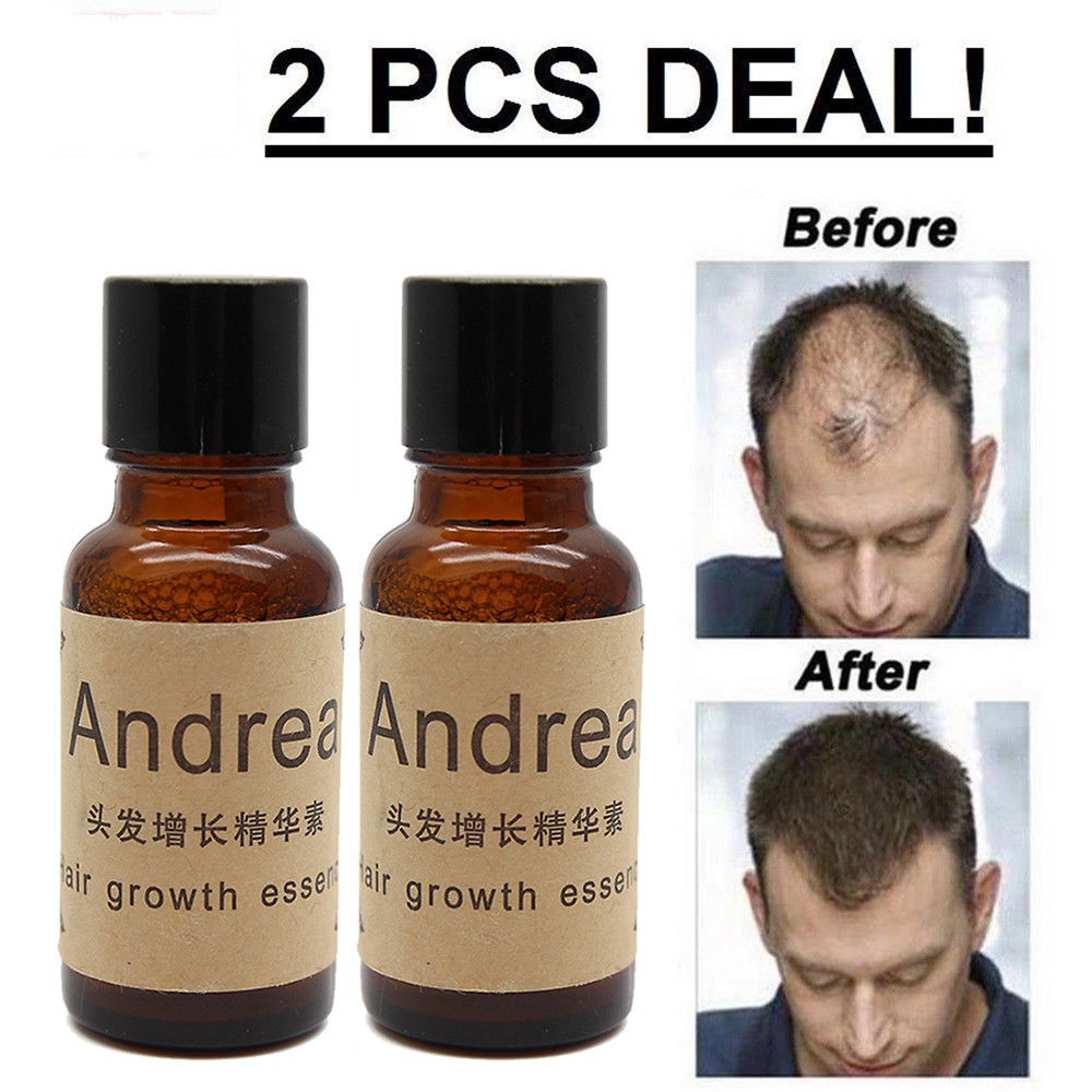 

2Pcs/1Set 20ml Andrea Hair Growth Essence Hair Loss Liquid
