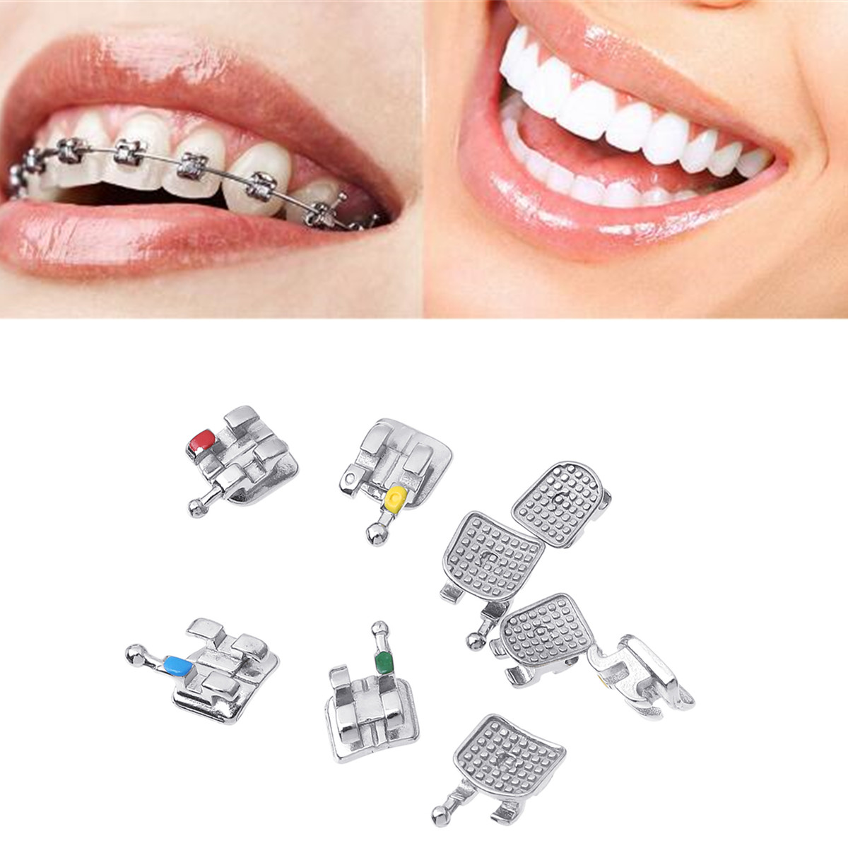 

10шт Зубной Металлический ортодонтический кронштейн Roth Mini
