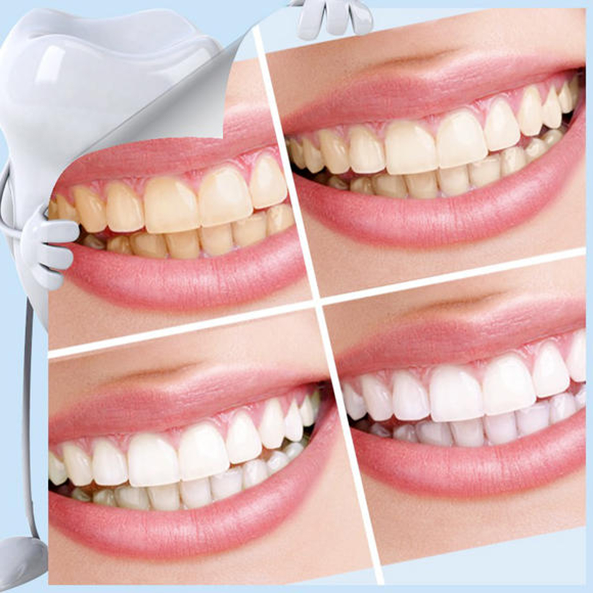 отбеливание и чистка зубов разница