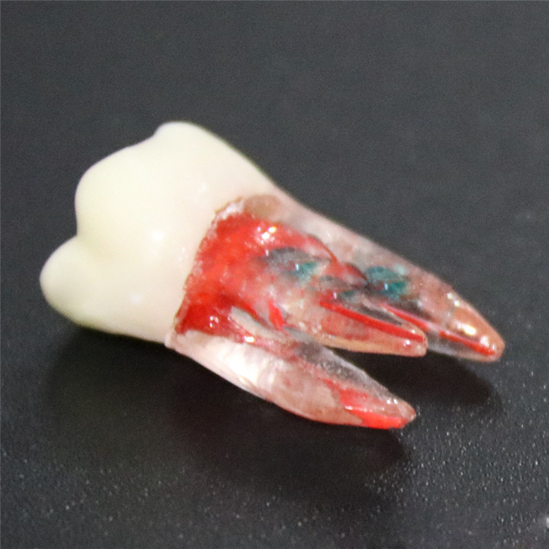 

Смола 1: 1 Зубной Эндодонтическая операция по изучению студента Операция Медицинская Модель Цветной корневой канал и пульпа Прозрачный без