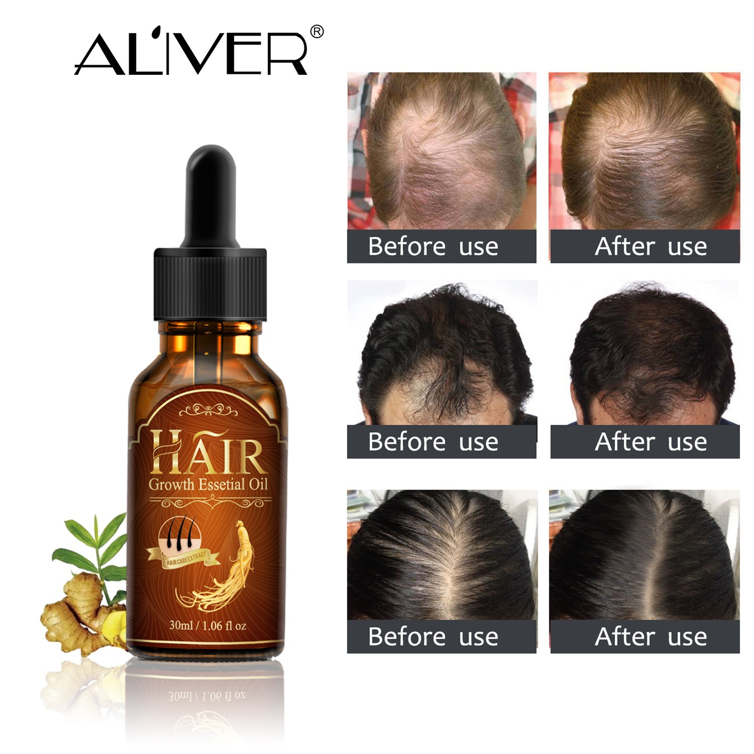 

Nourish Prevention Hair Repair Hair Growth Essential Oil