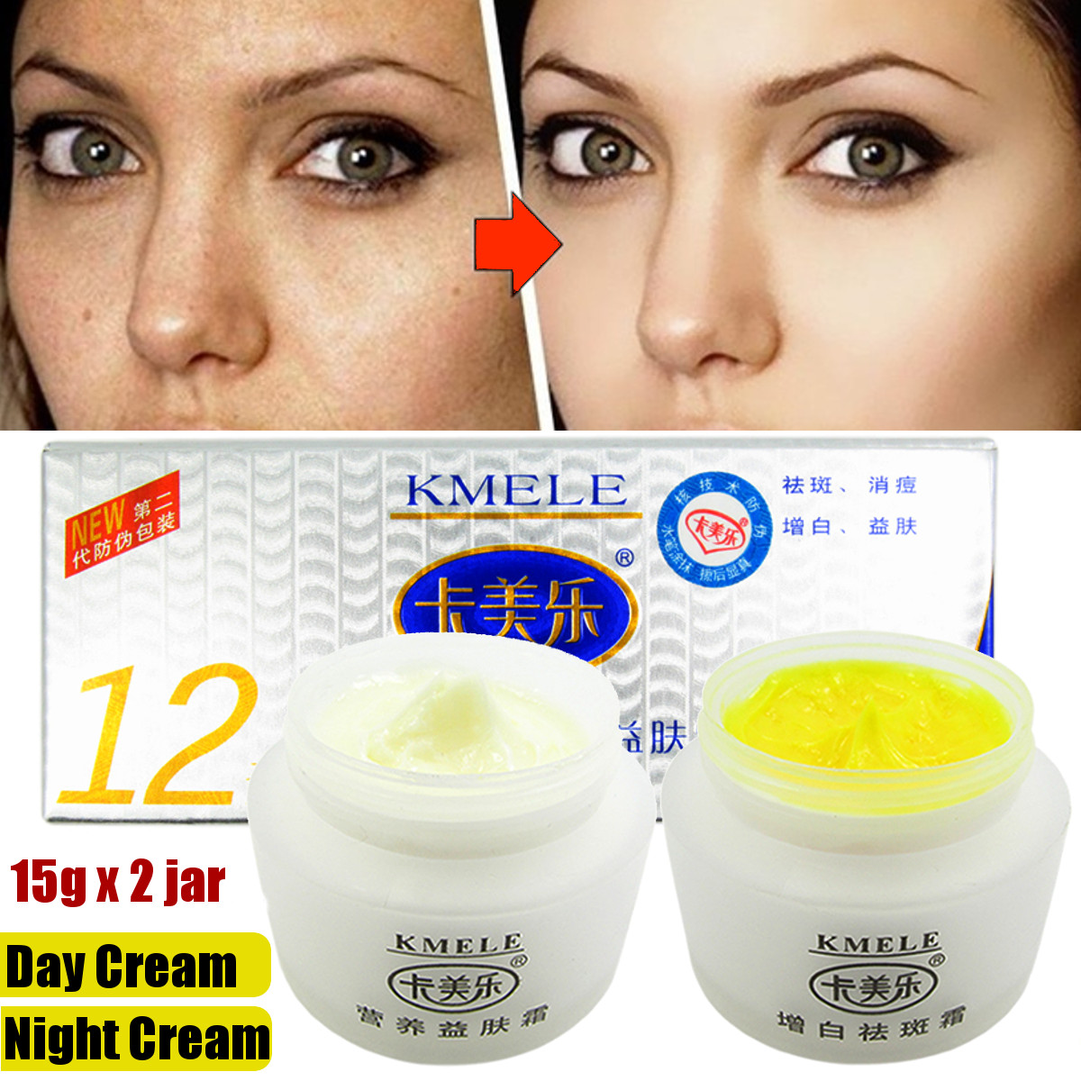 

12 DAYS EFFECT! KMELE Day & Night Scar Removal Cream Face Anti Freckle Brighten Whitening US