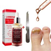 Version améliorée LANBENA Traitement liquide de réparation des ongles avec lime à ongles Anti Remove Nail Onychomycosis Fungus Toe Nail Care