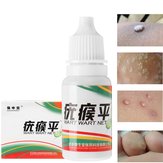 HOT Mole ve Cilt Siğil Çözünürlüğü Sıvı Çözüm 100% Remover Cilt Etiketleri Siğiller Moles