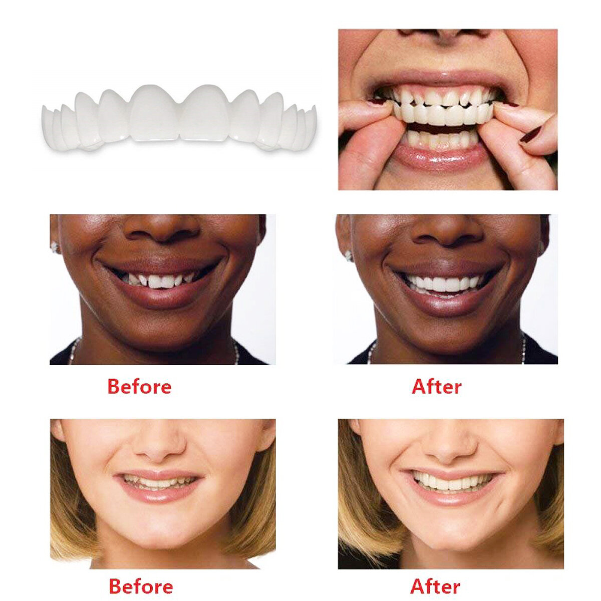 1 paar Tandheelkunde Cosmetische hoezen Smile Comfort Fineer Flex Tanden Bretels Boven + Onder