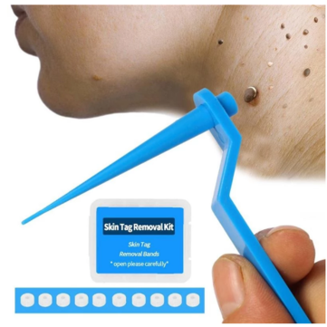 Skin Tag Kill Skin Mole Wart Remover Micro Band Skin Tag Removal Kit Adult Mole Wart Face Care
